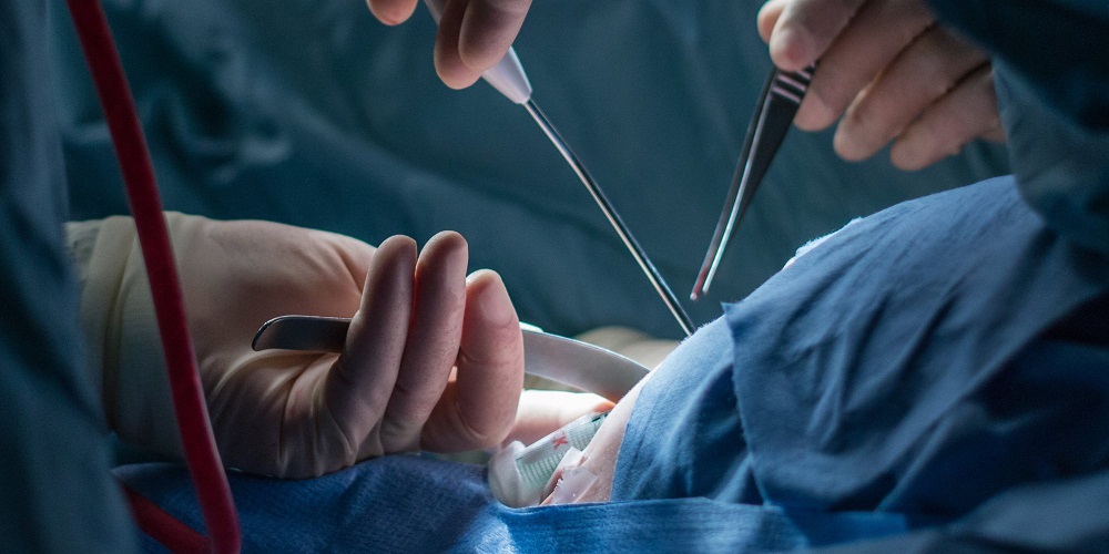 Genital Estetik Ameliyatı ne zaman yapılmalıdır?